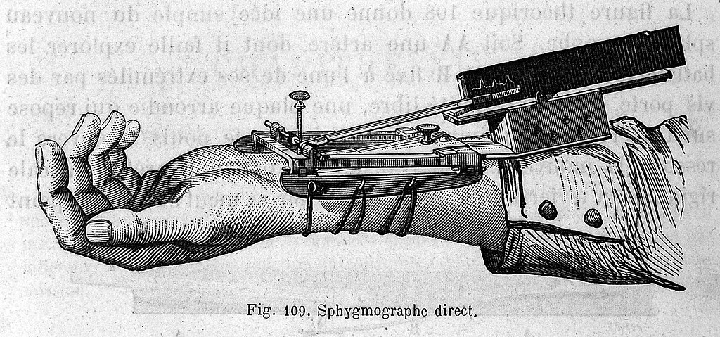 Sphymograph